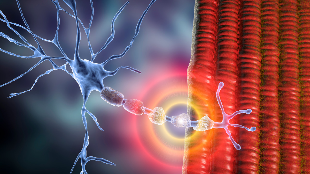 Demyelination of neuron, the damage of the neuron myelin sheath seen in demyelinating diseases, 3D illustration. Multiple sclerosis and other demyelinating myelinoclastic and leukodystrophic diseases